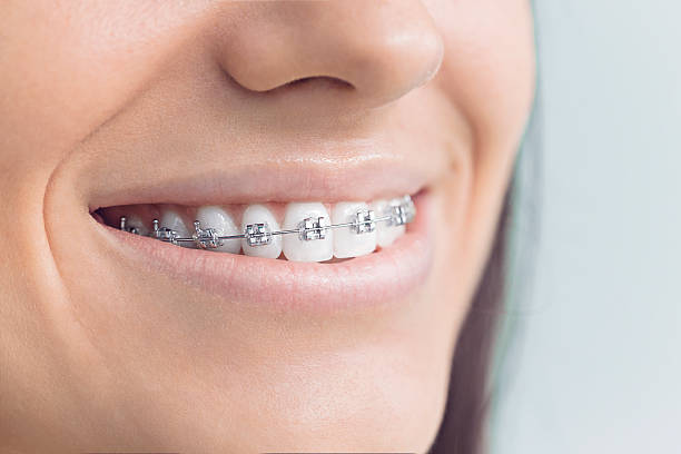 Best Dental Inlays and Onlays  in Sheffield, OH